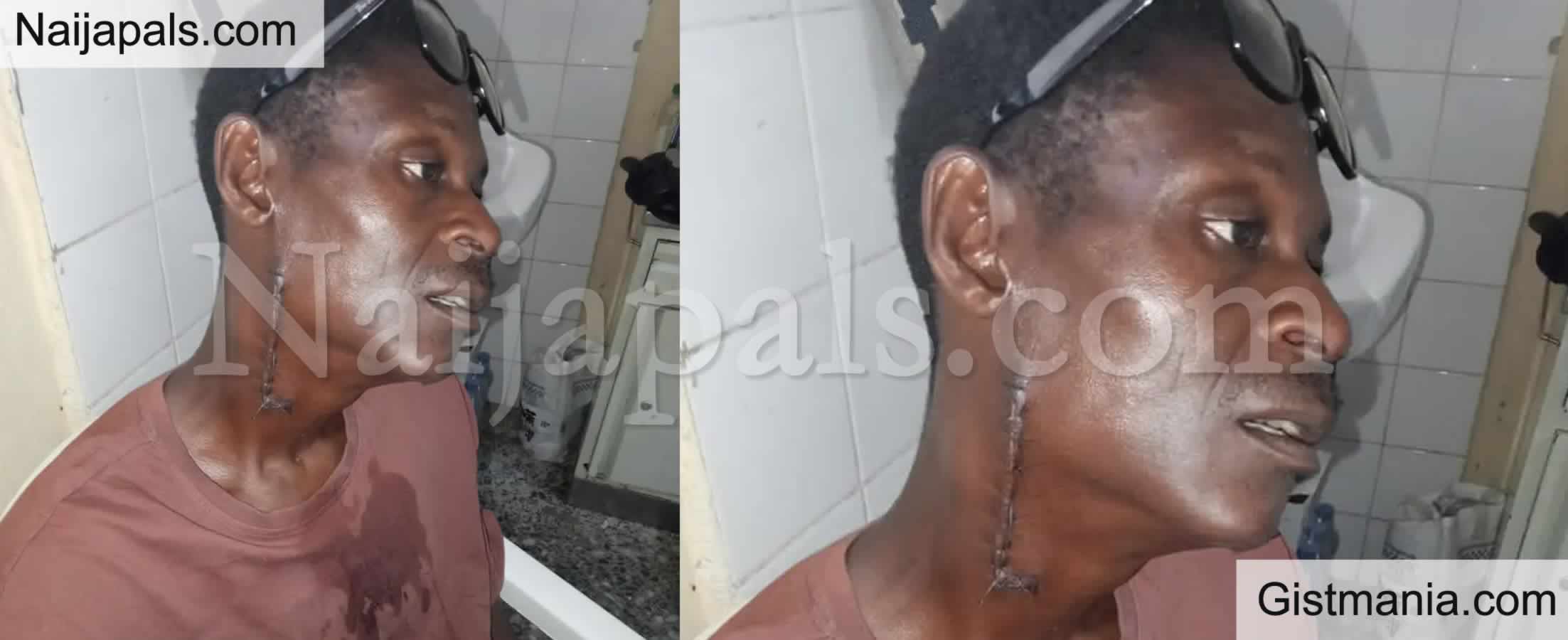 46yr Old Artisan Who Was Paralyzed From Bullets of a &#039;Trigger-Happy Policeman Cries Out For Help