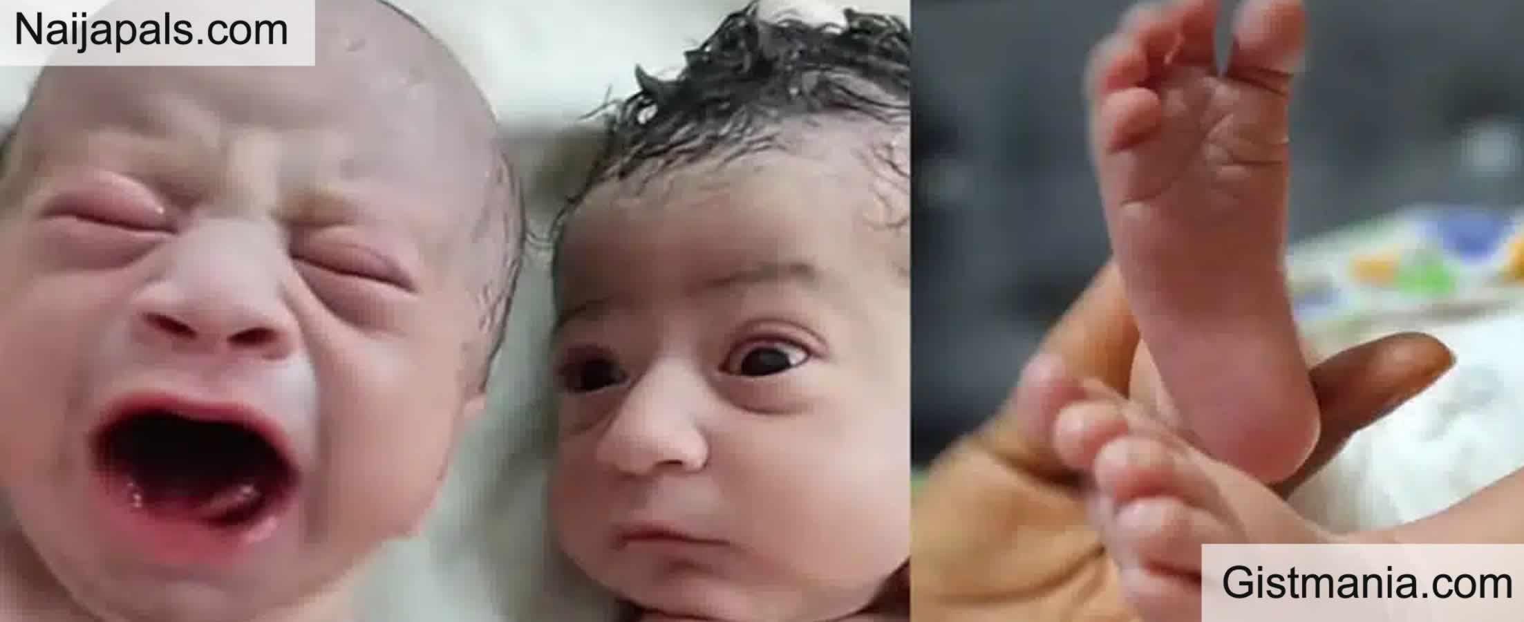 Newborn Baby Breaks Internet With Shocking Stare At His Crying Twin Brother