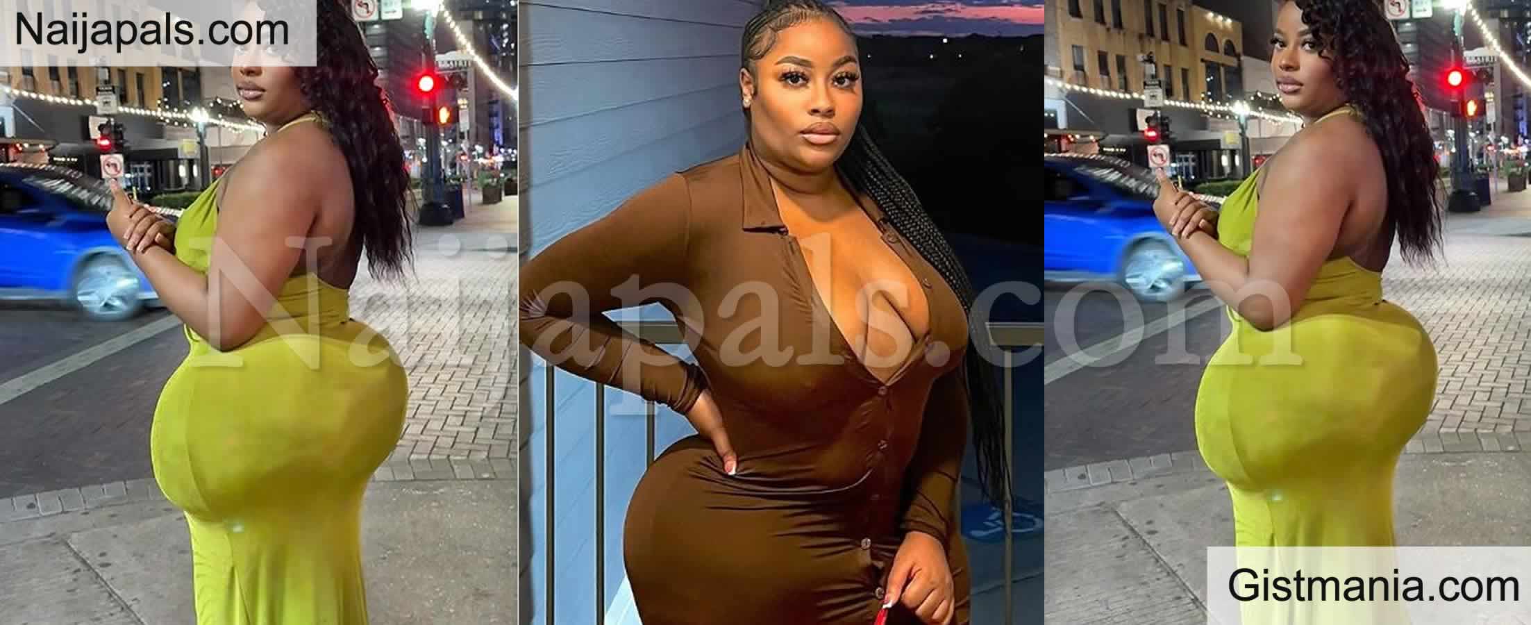 &quot;My BBL is Too Big And Nearly Killed Me&quot; - Woman Laments, Warns Others