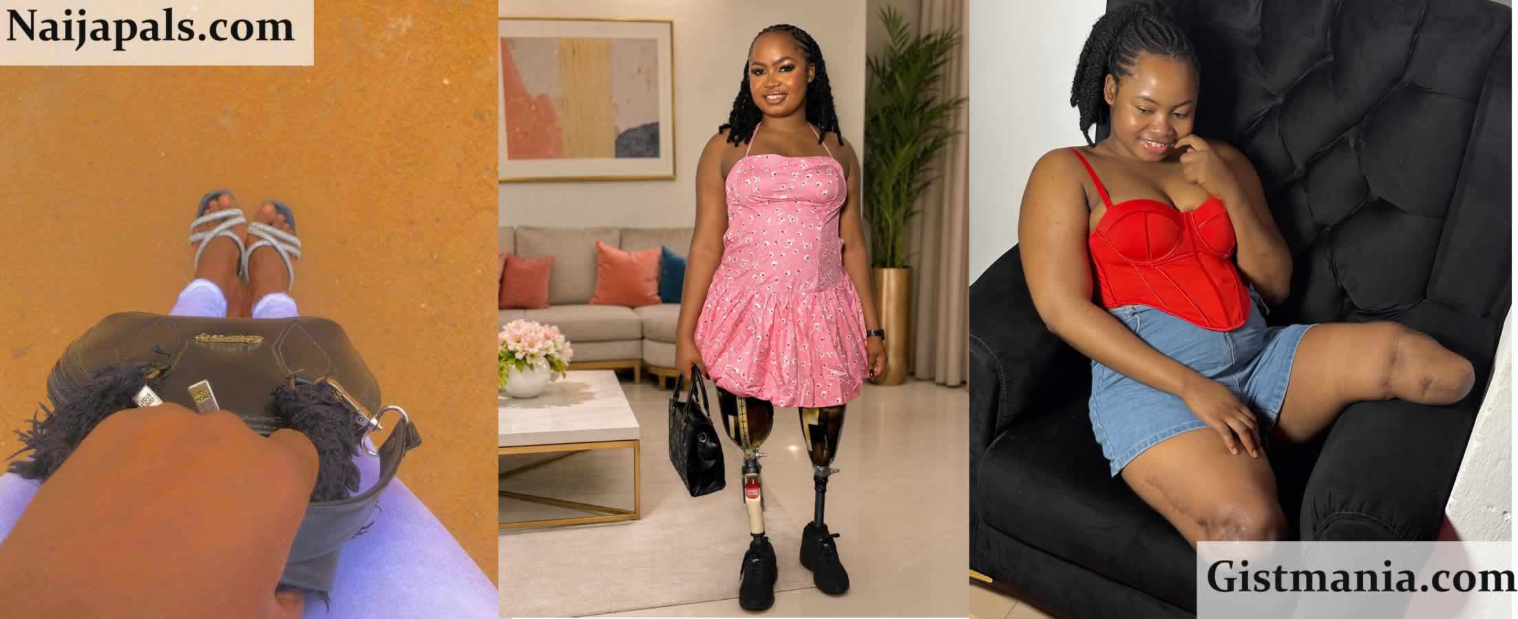 “I Wish I Had Stayed Home That Day” — Nigerian Woman Who Lost Both Legs in Accident Shares Regret