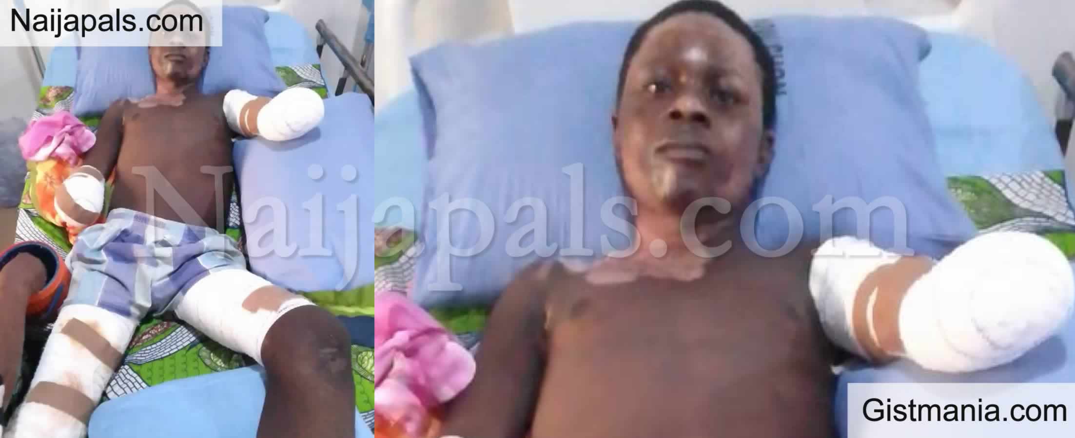 100L Taraba Poly Student Loses Both Hands After He Was Electrocuted While Hoisting a PDP Flag