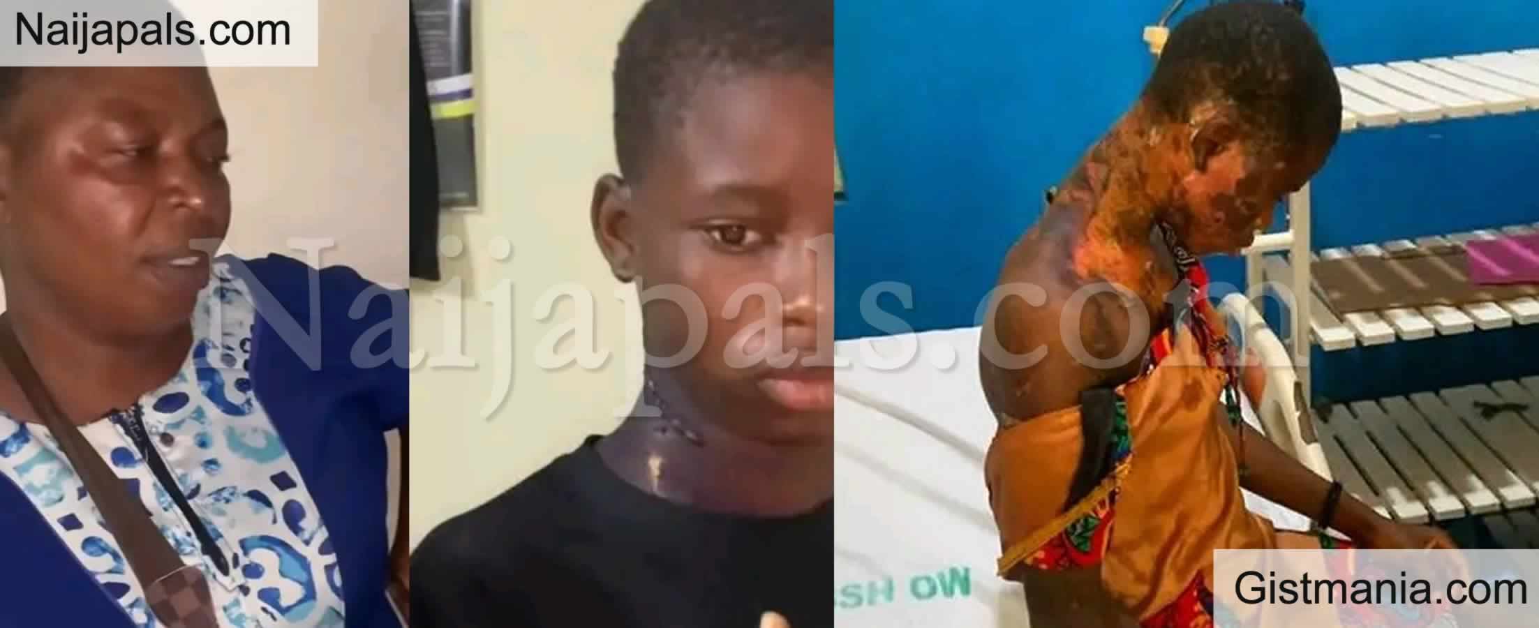 Court Jails Woman, Rose Okon For Pouring Hot Water on 14yr Old Niece in Imo