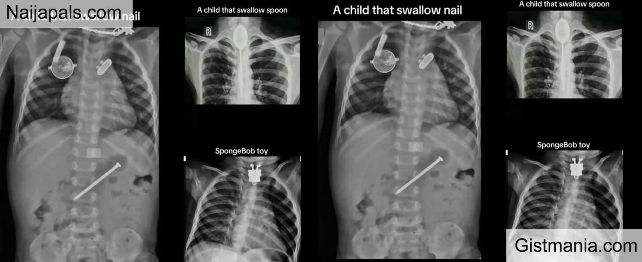 Medical Doctor Shares One-day Experience Working In Pediatric Clinic