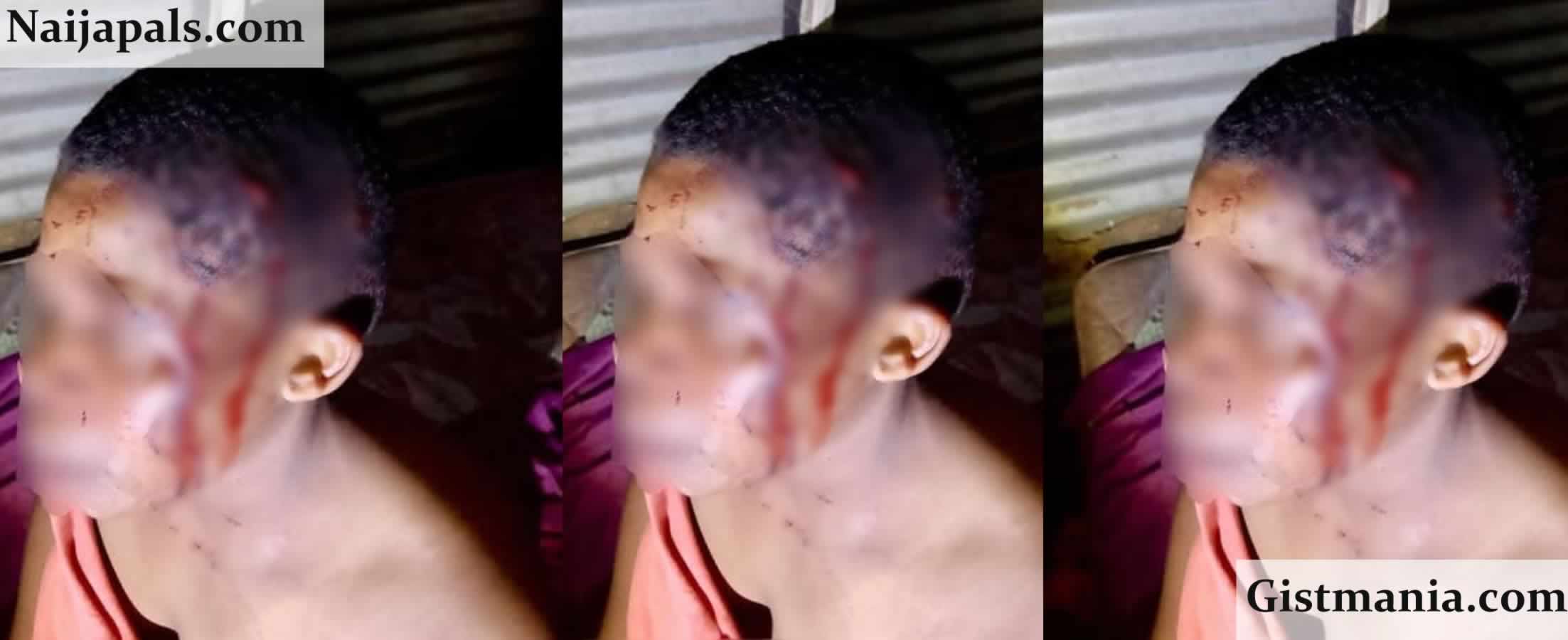 Jealous Ex-Lover Stabs Woman Repeatedly In Brutal Attack: Suspect On The Run