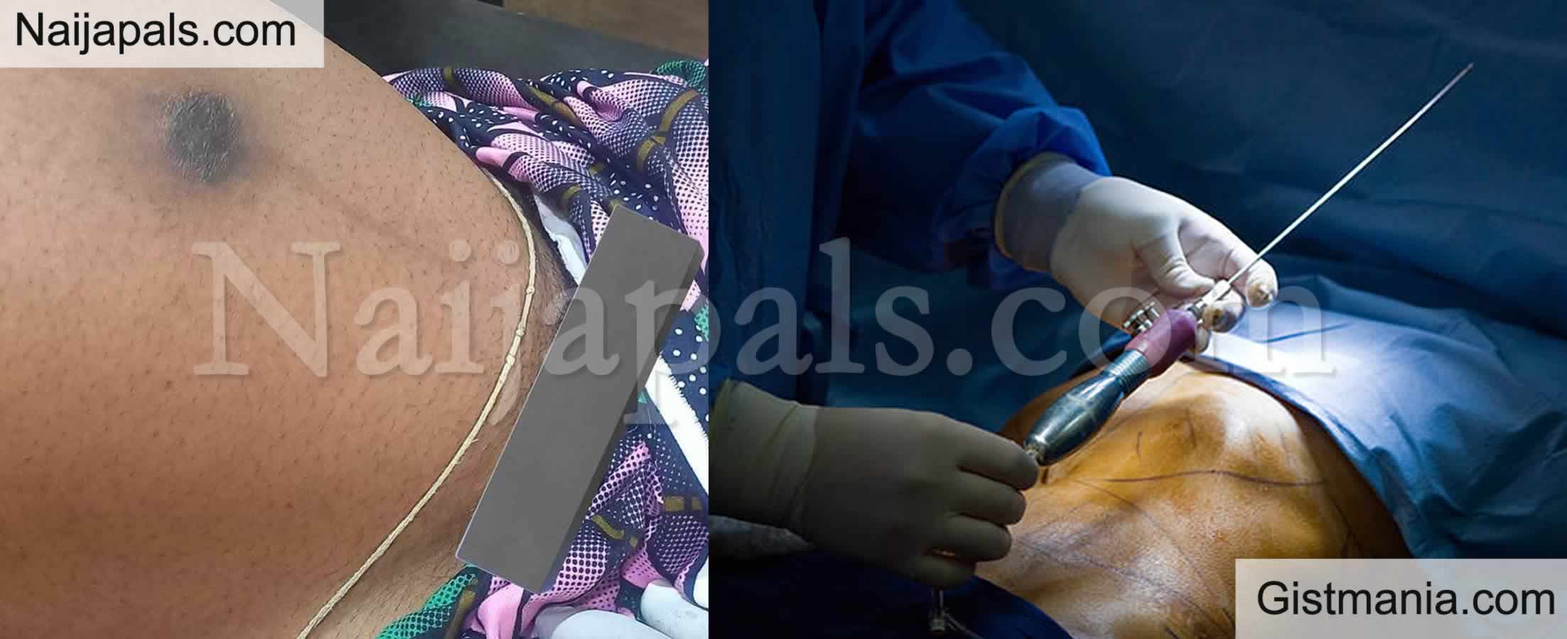 Remove Your Charms When Coming to Theatre For Surgery - Nigerian Doctor Warns
